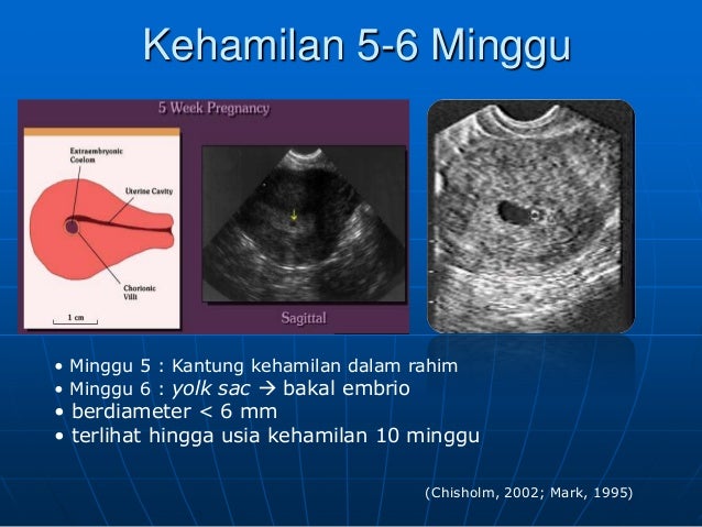 USG dasar dalam kehamilan