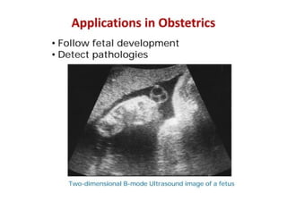 Comprehensive Overview of Ultrasound Imaging Techniques and ...
