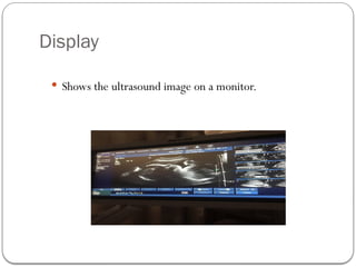 Display
 Shows the ultrasound image on a monitor.
 