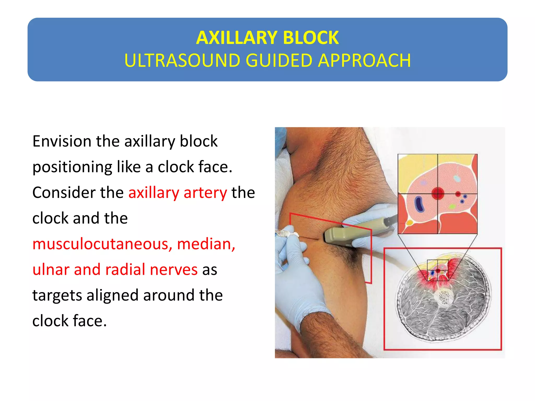 Usg r nerve block | PPTX
