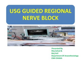 USG GUIDED REGIONAL
NERVE BLOCK
Presented By.
Maj Zahed &
Maj Arif
Department Of Anaesthesiology
CMH DHAKA
 