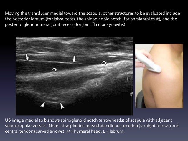 Ultrasound shoulder and knee joints