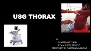 USG THORAX
BY
Dr NARENDRA TENGLI
2nd year JUNIOR RESIDENT
DEPARTMENT OF PULMONARY MEDICINE
 