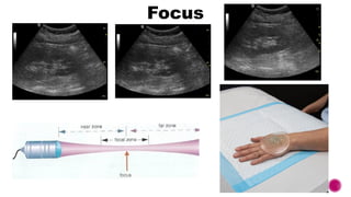 Introduction to Ultrasound Transducers and Knobology | PPTX