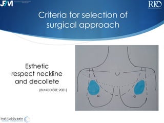 !
Esthetic
respect neckline
and decollete
(BUNODIERE 2001)
Criteria for selection of
surgical approach
 