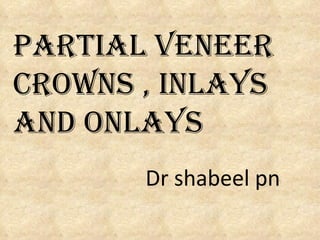 Partial Veneer Crowns , Inlays and Onlays Dr shabeel pn 