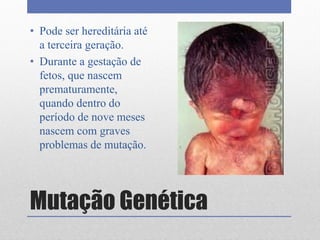 Mutação Genética
• Pode ser hereditária até
a terceira geração.
• Durante a gestação de
fetos, que nascem
prematuramente,
quando dentro do
período de nove meses
nascem com graves
problemas de mutação.
 