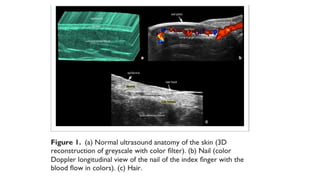 ULTRA SOUND IN DERMATOLOGY recent advances | PPTX