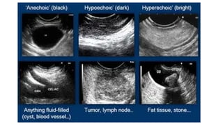 ULTRA SOUND IN DERMATOLOGY recent advances | PPTX