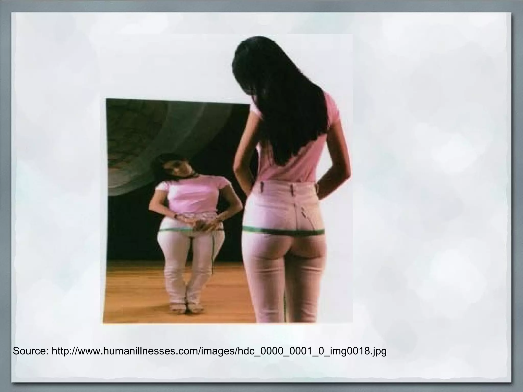 Source: http://www.humanillnesses.com/images/hdc_0000_0001_0_img0018.jpg 