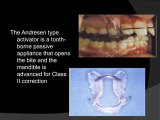 Using activator as first phase of treatment | PPT