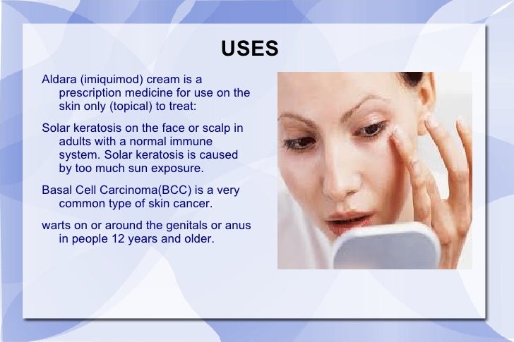 Aldara 5 cream genital warts skin