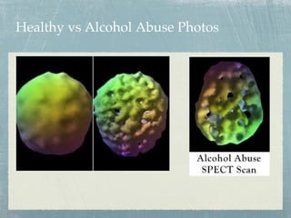 Healthy vs Alcohol Abuse Photos
 