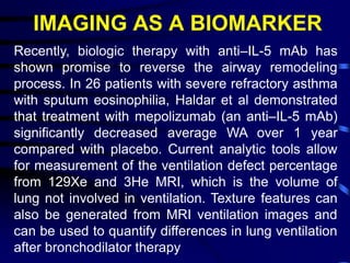 IMAGING AS A BIOMARKER
Recently, biologic therapy with anti–IL-5 mAb has
shown promise to reverse the airway remodeling
process. In 26 patients with severe refractory asthma
with sputum eosinophilia, Haldar et al demonstrated
that treatment with mepolizumab (an anti–IL-5 mAb)
significantly decreased average WA over 1 year
compared with placebo. Current analytic tools allow
for measurement of the ventilation defect percentage
from 129Xe and 3He MRI, which is the volume of
lung not involved in ventilation. Texture features can
also be generated from MRI ventilation images and
can be used to quantify differences in lung ventilation
after bronchodilator therapy
 