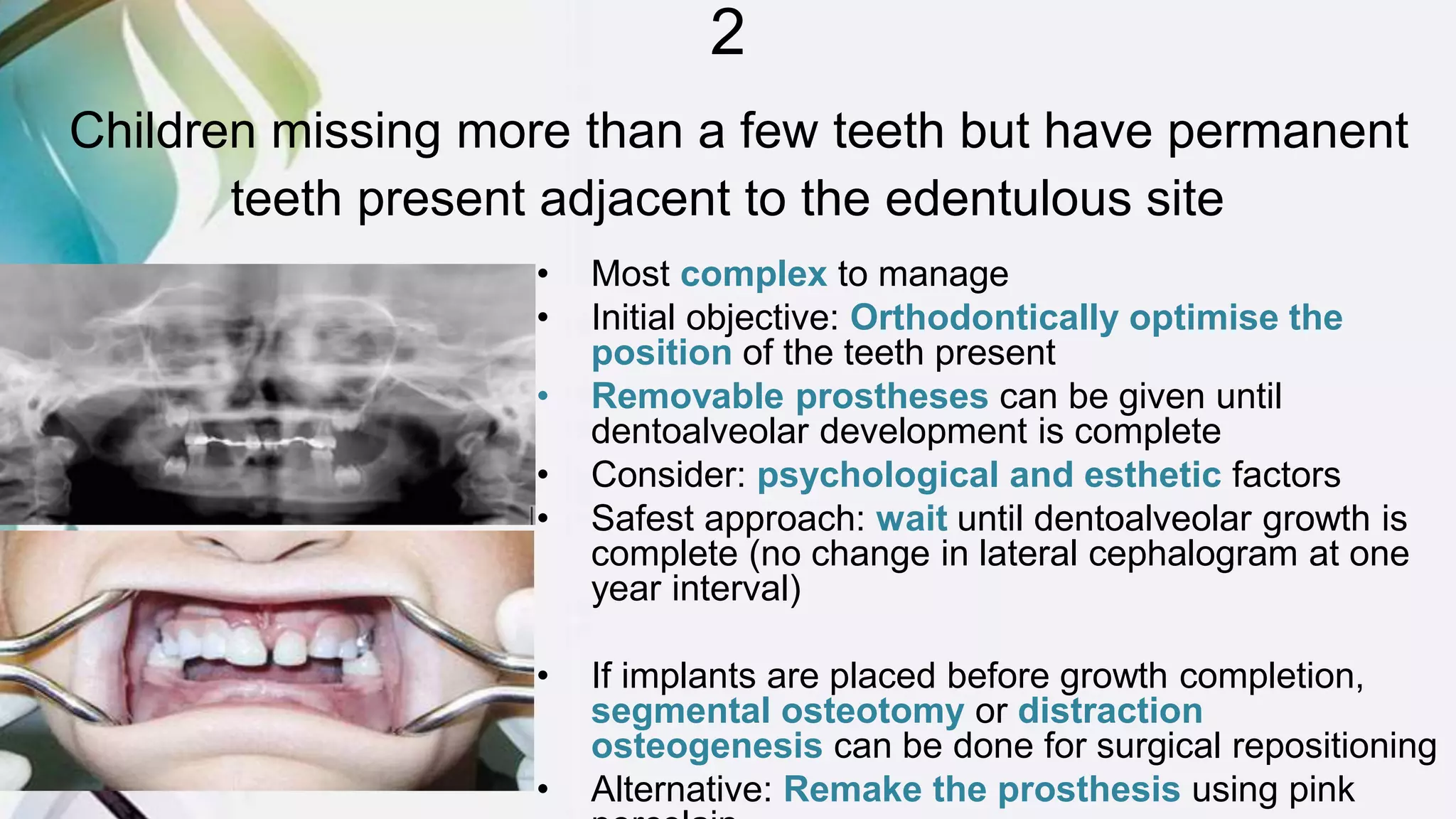 2
Children missing more than a few teeth but have permanent
teeth present adjacent to the edentulous site
• Most complex to manage
• Initial objective: Orthodontically optimise the
position of the teeth present
• Removable prostheses can be given until
dentoalveolar development is complete
• Consider: psychological and esthetic factors
• Safest approach: wait until dentoalveolar growth is
complete (no change in lateral cephalogram at one
year interval)
• If implants are placed before growth completion,
segmental osteotomy or distraction
osteogenesis can be done for surgical repositioning
• Alternative: Remake the prosthesis using pink
 
