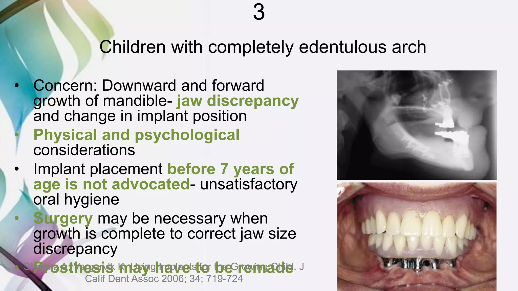 3
Children with completely edentulous arch
• Concern: Downward and forward
growth of mandible- jaw discrepancy
and change in implant position
• Physical and psychological
considerations
• Implant placement before 7 years of
age is not advocated- unsatisfactory
oral hygiene
• Surgery may be necessary when
growth is complete to correct jaw size
discrepancy
• Prosthesis may have to be remadeSharma A, Vargervik K. Using Implants for the Growing Child. J
Calif Dent Assoc 2006; 34; 719-724
 