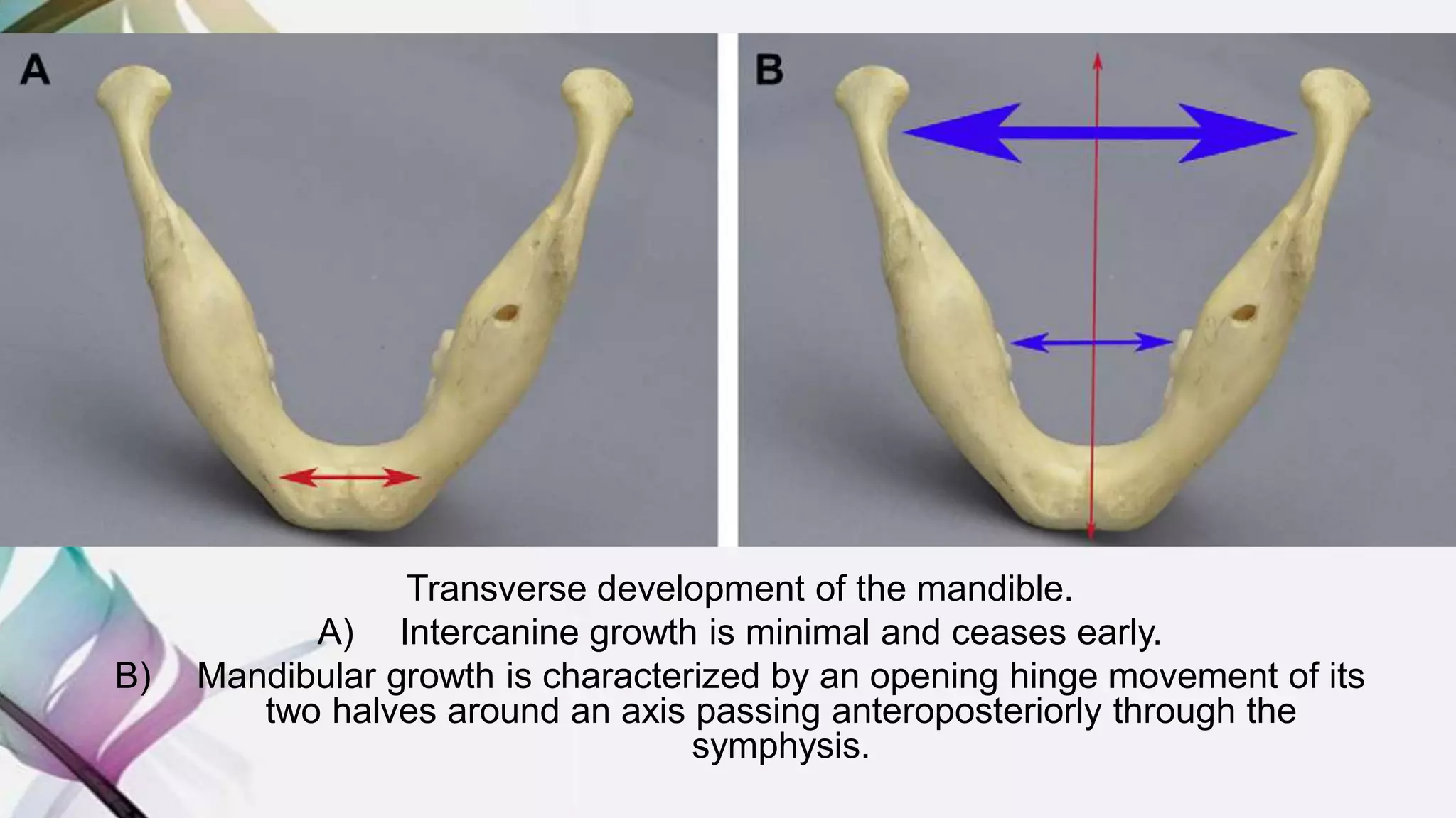Transverse development of the mandible.
A) Intercanine growth is minimal and ceases early.
B) Mandibular growth is characterized by an opening hinge movement of its
two halves around an axis passing anteroposteriorly through the
symphysis.
 