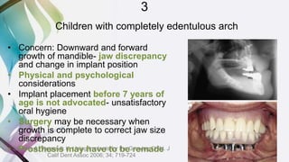 3
Children with completely edentulous arch
• Concern: Downward and forward
growth of mandible- jaw discrepancy
and change in implant position
• Physical and psychological
considerations
• Implant placement before 7 years of
age is not advocated- unsatisfactory
oral hygiene
• Surgery may be necessary when
growth is complete to correct jaw size
discrepancy
• Prosthesis may have to be remadeSharma A, Vargervik K. Using Implants for the Growing Child. J
Calif Dent Assoc 2006; 34; 719-724
 