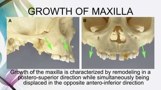 GROWTH OF MAXILLA
Growth of the maxilla is characterized by remodeling in a
postero-superior direction while simultaneously being
displaced in the opposite antero-inferior direction
 