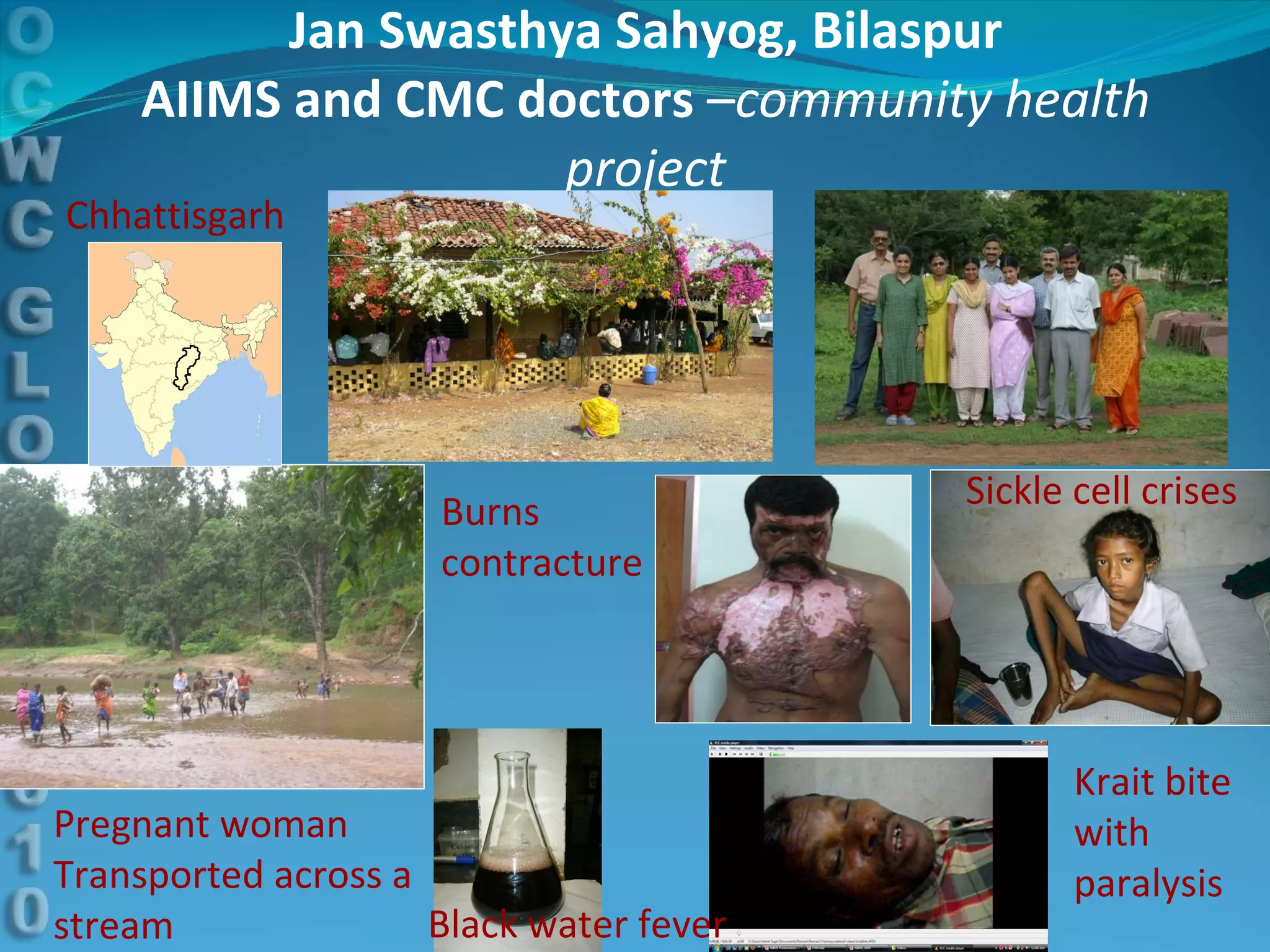 Jan Swasthya Sahyog, Bilaspur AIIMS and CMC doctors  – community health project Chhattisgarh Pregnant woman  Transported across a  stream Black water fever Burns contracture Sickle cell crises Krait bite with  paralysis 