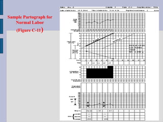 USING PARTOGRAPH.ppt student 2023 slidevvvvvvvvvvvccc | PPT