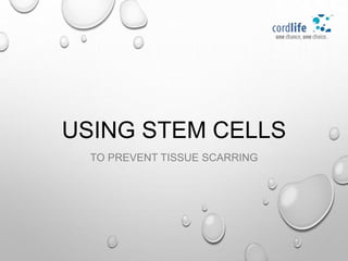 USING STEM CELLS
TO PREVENT TISSUE SCARRING
 