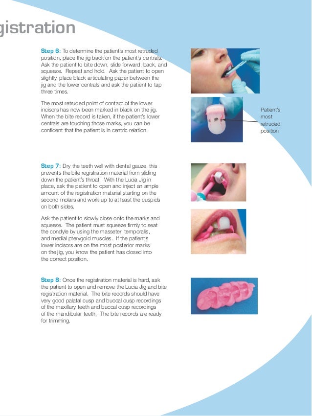 Using the lucia jig for accurate bite s220