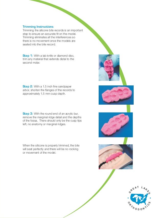 Using the lucia jig for accurate bite s220
