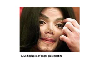 9. Michael Jackson's nose disintegrating
 
