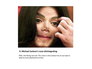 9. Michael Jackson's nose disintegrating
REAL. Horrifying, but real. The rumor is that Jackson has to use tape to
keep his nose attached to his face.
 