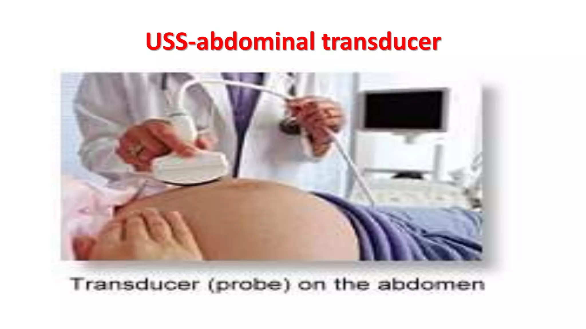 USS-abdominal transducer
 