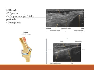 BOLSAS:
-Pré patelar
-Infra patelar superficial e
profunda
- Suprapatelar
 