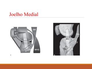 Joelho Medial
 