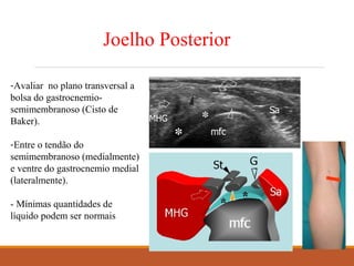 Joelho Posterior
-Avaliar no plano transversal a
bolsa do gastrocnemio-
semimembranoso (Cisto de
Baker).
-Entre o tendão do
semimembranoso (medialmente)
e ventre do gastrocnemio medial
(lateralmente).
- Mínimas quantidades de
líquido podem ser normais
 