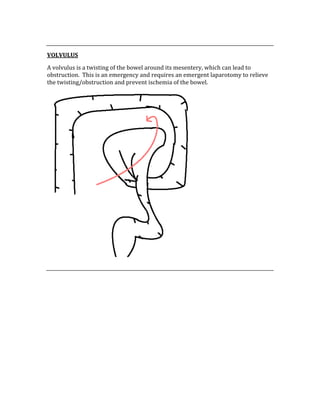  
VOLVULUS 
A volvulus is a twisting of the bowel around its mesentery, which can lead to 
obstruction.  This is an emergency and requires an emergent laparotomy to relieve 
the twisting/obstruction and prevent ischemia of the bowel. 
 
 
 
 
 
 
 
 
 
 
 