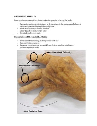  
RHEUMATOID ARTHRITIS 
Is an autoimmune condition that attacks the synovial joints of the body. 
‐ Pannus formation in joints leads to deformities of the metacarpophalangeal 
joints and proximal interphalangeal joints. 
‐ Formation of subcutaneous nodules 
‐ Ulnar deviation at the wrist joint 
‐ Seen in females >>> males 
Presentation of Rheumatoid Arthritis: 
‐ Stiffness in the morning that improves with use 
‐ Symmetric involvement 
‐ Systemic symptoms are present (fever, fatigue, cardiac conditions, 
pulmonary conditions) 
 
 