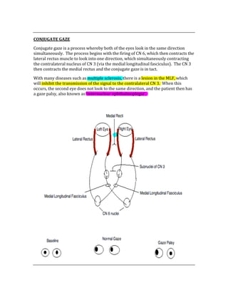  
CONJUGATE GAZE 
Conjugate gaze is a process whereby both of the eyes look in the same direction 
simultaneously.  The process begins with the firing of CN 6, which then contracts the 
lateral rectus muscle to look into one direction, which simultaneously contracting 
the contralateral nucleus of CN 3 (via the medial longitudinal fasciculus).  The CN 3 
then contracts the medial rectus and the conjugate gaze is in tact.   
With many diseases such as multiple sclerosis, there is a lesion in the MLF, which 
will inhibit the transmission of the signal to the contralateral CN 3.  When this 
occurs, the second eye does not look to the same direction, and the patient then has 
a gaze palsy, also known as ‘internuclear ophthalmoplegia’. 
 
 