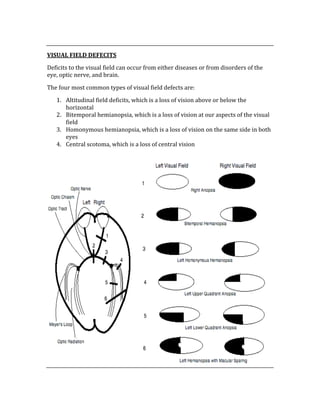  
VISUAL FIELD DEFECITS 
Deficits to the visual field can occur from either diseases or from disorders of the 
eye, optic nerve, and brain.   
The four most common types of visual field defects are: 
1. Altitudinal field deficits, which is a loss of vision above or below the 
horizontal 
2. Bitemporal hemianopsia, which is a loss of vision at our aspects of the visual 
field 
3. Homonymous hemianopsia, which is a loss of vision on the same side in both 
eyes 
4. Central scotoma, which is a loss of central vision 
 
 