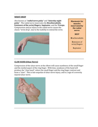  
WRIST DROP 
Also known as “radial nerve palsy” and “Saturday night 
palsy”.  The radial nerve innervates the Brachioradialis, 
Extensors of the wrist/fingers, Supinator, and the Triceps.  
Compression and/or injury to the radial nerve causes the 
classic “wrist drop”, due to the inability to extend the wrist. 
 
 
CLAW HAND (Ulnar Nerve) 
Compression of the ulnar nerve at the elbow will cause numbness of the small finger 
and the medial aspect of the ring finger.  With time, weakness of the hand will 
produce the “claw hand”, where the small finger and the ring finger contract and 
form a “claw”.  This is late sequelae of ulnar nerve injury, and is a sign of a severely 
injured ulnar nerve. 
 
 
 
Mnemonic for 
muscles 
innervated by 
the radial 
nerve: 
BEST 
Brachioradialis 
Extensors of 
wrist/fingers 
Supinator 
Triceps 
 