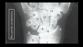 Ultrasound Imaging of the Wrist: Tendons, Nerves, Bone Cortex, and ...