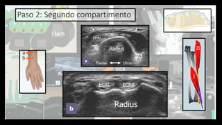 Ultrasound Imaging of the Wrist: Tendons, Nerves, Bone Cortex, and ...