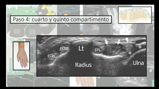 Ultrasound Imaging of the Wrist: Tendons, Nerves, Bone Cortex, and ...