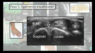 Ultrasound Imaging of the Wrist: Tendons, Nerves, Bone Cortex, and ...