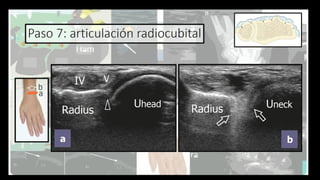 Ultrasound Imaging of the Wrist: Tendons, Nerves, Bone Cortex, and ...