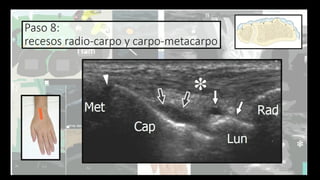 Ultrasound Imaging of the Wrist: Tendons, Nerves, Bone Cortex, and ...