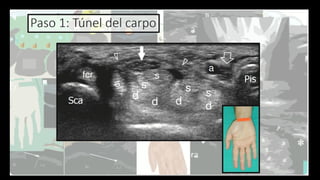 Ultrasound Imaging of the Wrist: Tendons, Nerves, Bone Cortex, and ...
