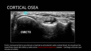 Ultrasound Imaging of the Wrist: Tendons, Nerves, Bone Cortex, and ...