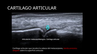 Ultrasound Imaging of the Wrist: Tendons, Nerves, Bone Cortex, and ...