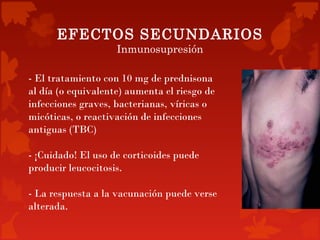 EFECTOS SECUNDARIOS
                    Inmunosupresión

- El tratamiento con 10 mg de prednisona
al día (o equivalente) aumenta el riesgo de
infecciones graves, bacterianas, víricas o
micóticas, o reactivación de infecciones
antiguas (TBC)

- ¡Cuidado! El uso de corticoides puede
producir leucocitosis.

- La respuesta a la vacunación puede verse
alterada.
 