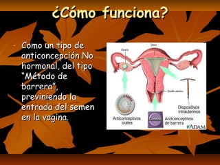 ¿Cómo funciona?¿Cómo funciona?
- Como un tipo deComo un tipo de
anticoncepción Noanticoncepción No
hormonal, del tipohormonal, del tipo
“Método de“Método de
barrera”,barrera”,
previniendo lapreviniendo la
entrada del semenentrada del semen
en la vagina.en la vagina.
 